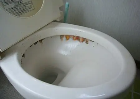 便器のフチ汚れ